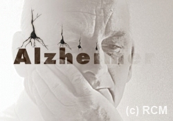 Alzheimer