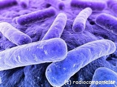 legionella